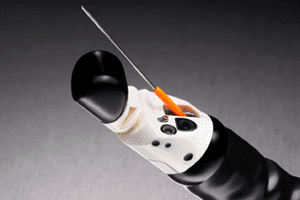Image: The Expect Endoscopic Ultrasound aspiration needle (Photo courtesy of Boston Scientific). Image: The Expect Endoscopic Ultrasound aspiration needle (Photo courtesy of Boston Scientific).